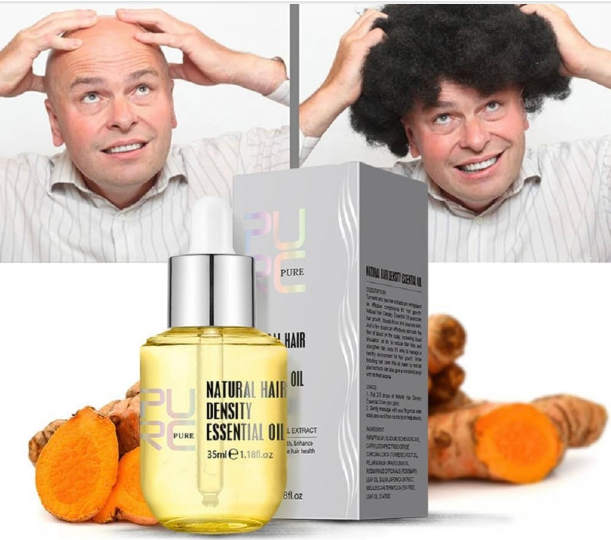 Ginger Scalp Revival Kit (3-in-1 Hair Growth System)